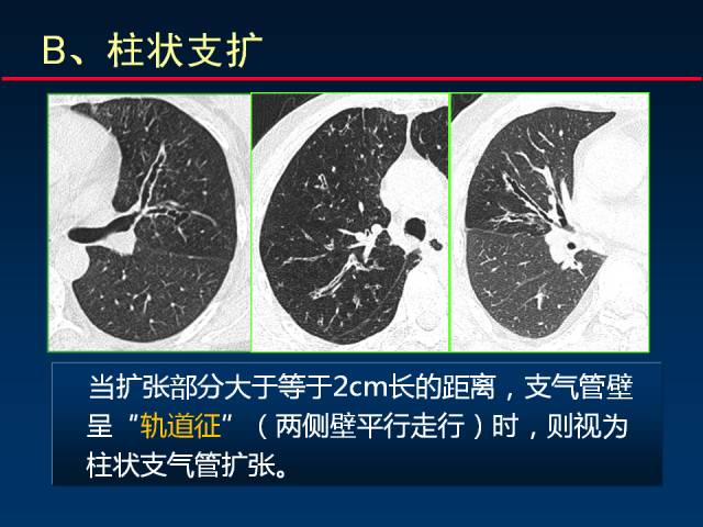 【PPT】肺实质与支气管——基本CT征象的定义与诠释