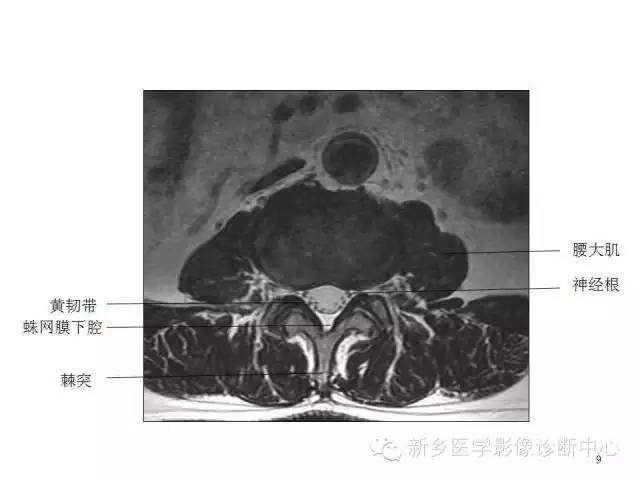 这样诊断“腰椎间盘突出”才更专业 这样诊断“腰椎间盘突出”才更专业