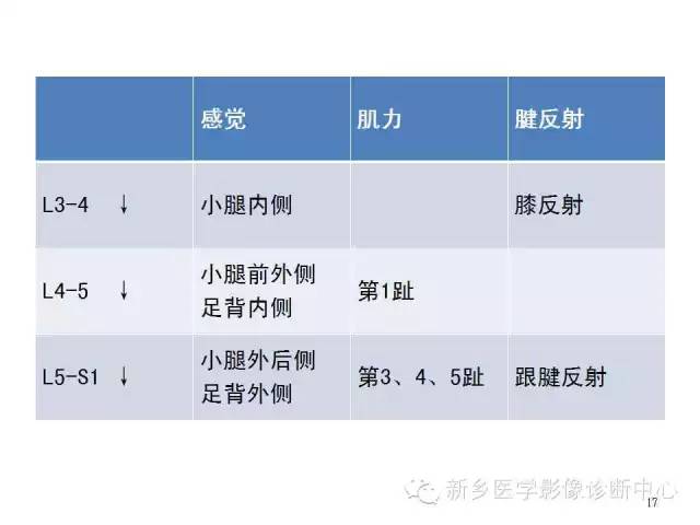 这样诊断“腰椎间盘突出”才更专业 这样诊断“腰椎间盘突出”才更专业