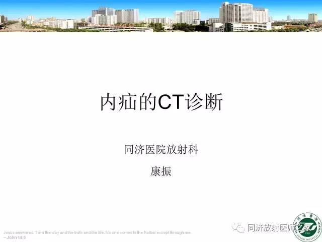 【PPT】内疝的CT诊断