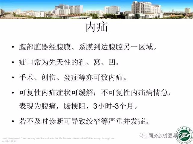 【PPT】内疝的CT诊断