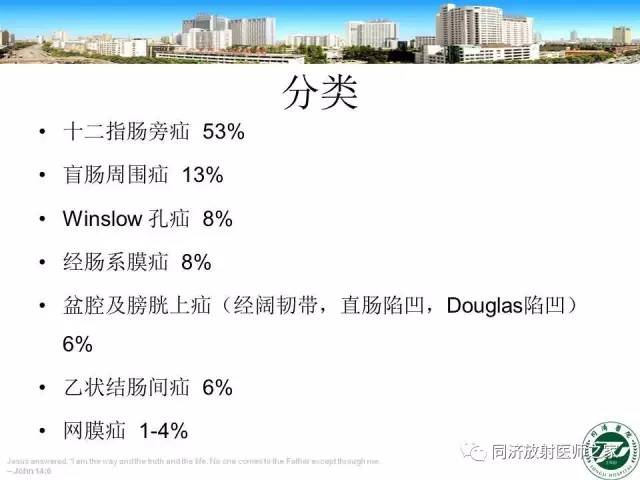 【PPT】内疝的CT诊断