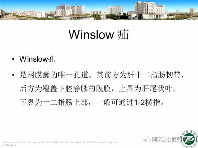 【PPT】内疝的CT诊断