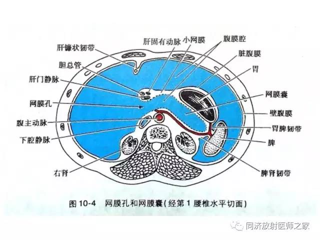 【PPT】内疝的CT诊断