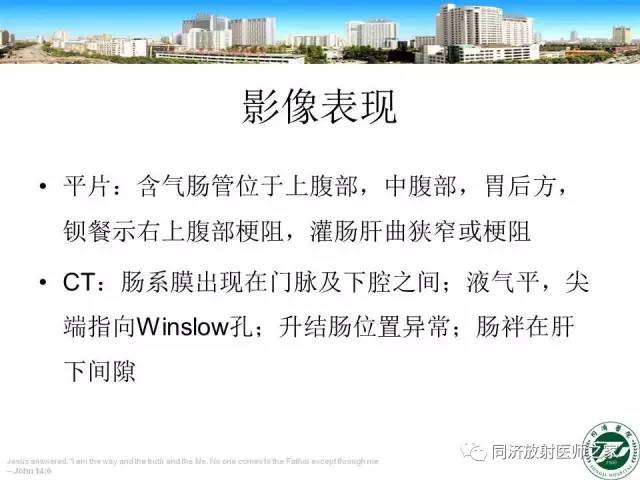 【PPT】内疝的CT诊断
