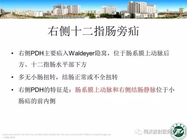 【PPT】内疝的CT诊断