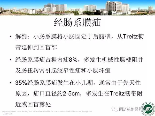 【PPT】内疝的CT诊断