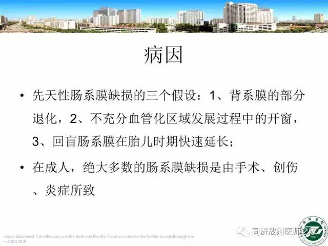 【PPT】内疝的CT诊断