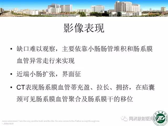 【PPT】内疝的CT诊断