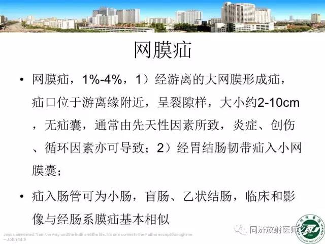 【PPT】内疝的CT诊断
