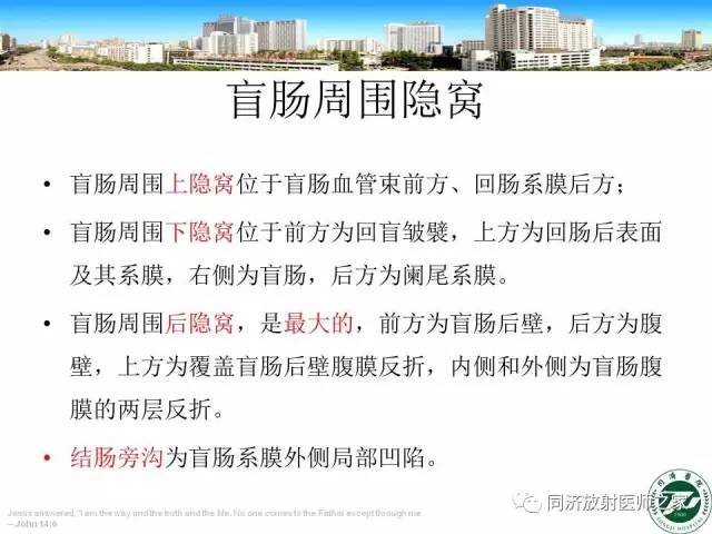 【PPT】内疝的CT诊断