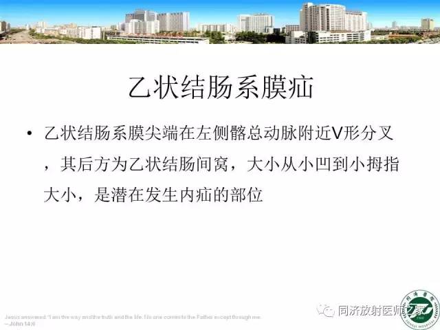 【PPT】内疝的CT诊断