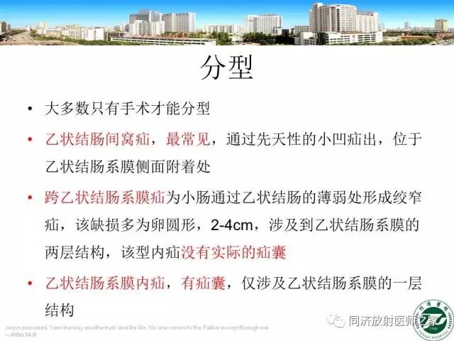 【PPT】内疝的CT诊断