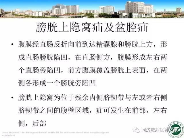 【PPT】内疝的CT诊断