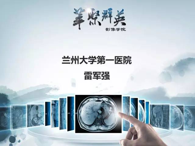【病例】肝淋巴瘤1例CT影像表现
