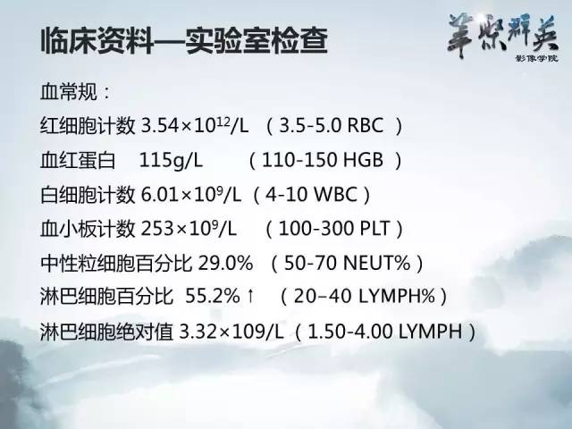 【病例】肝淋巴瘤1例CT影像表现