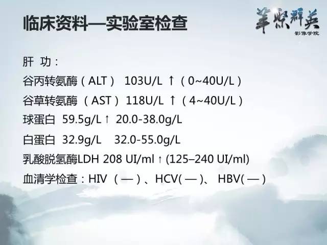 【病例】肝淋巴瘤1例CT影像表现