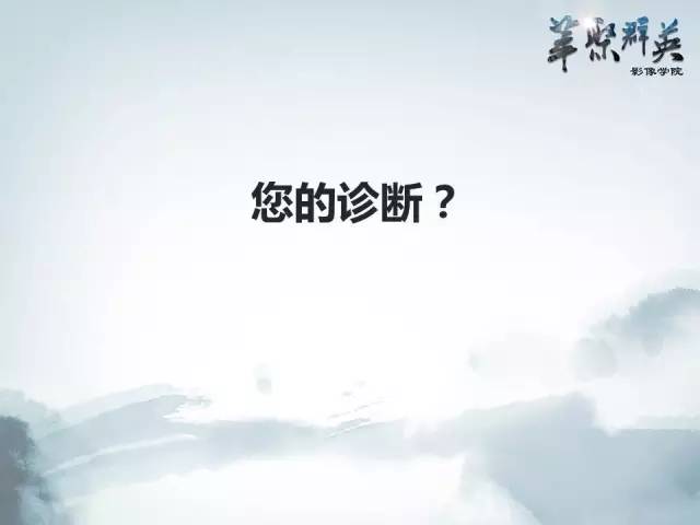 【病例】肝淋巴瘤1例CT影像表现