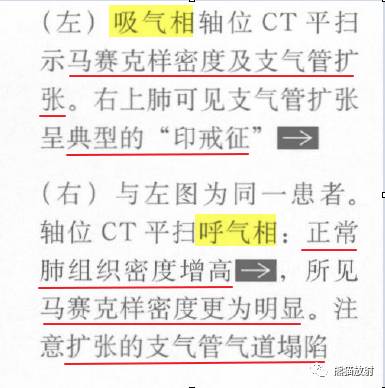 【书摘】“马赛克征”的鉴别诊断 【书摘】“马赛克征”的鉴别诊断