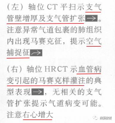 【书摘】“马赛克征”的鉴别诊断 【书摘】“马赛克征”的鉴别诊断