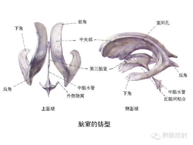 【PPT】脑室内肿瘤影像学表现 【PPT】脑室内肿瘤影像学表现