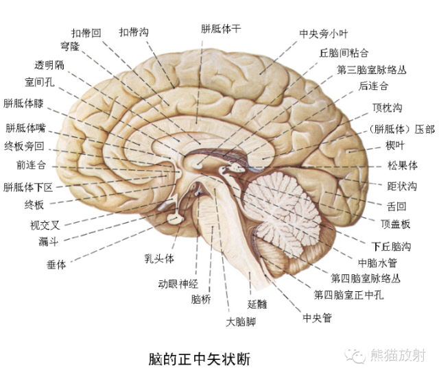 【PPT】脑室内肿瘤影像学表现 【PPT】脑室内肿瘤影像学表现