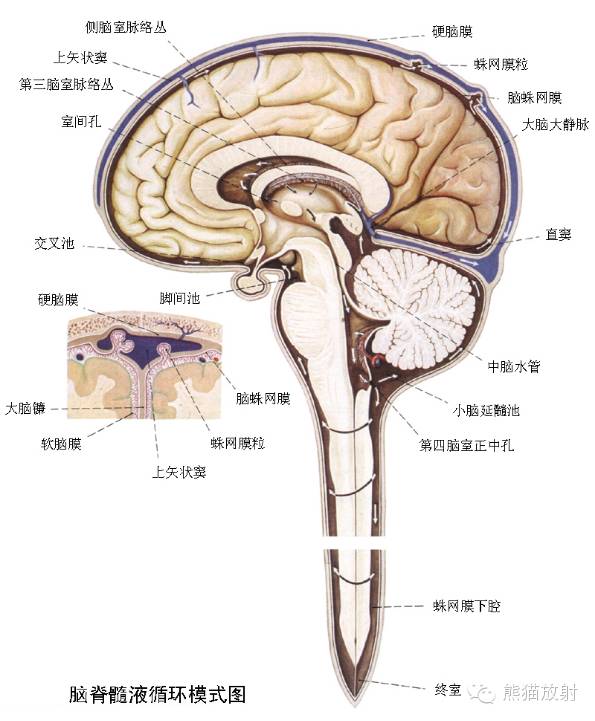 【PPT】脑室内肿瘤影像学表现 【PPT】脑室内肿瘤影像学表现