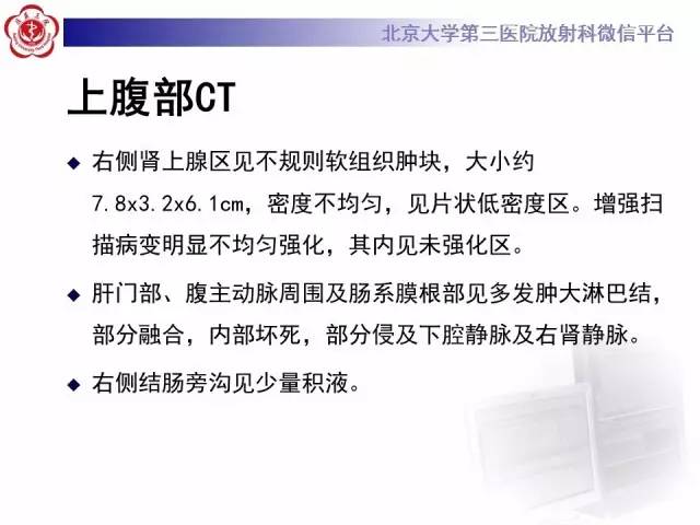 【病例】囊腔类肺癌1例CT影像表现