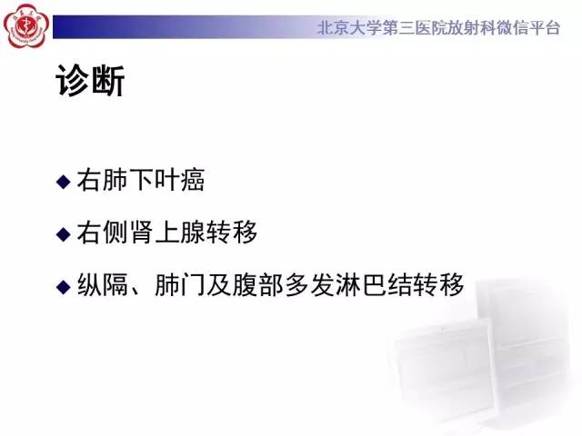 【病例】囊腔类肺癌1例CT影像表现