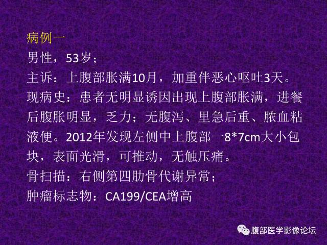 【病例】腹部外周恶性神经外胚叶肿瘤1例CT