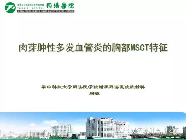 【PPT】肉芽肿性多发血管炎的胸部MSCT特征