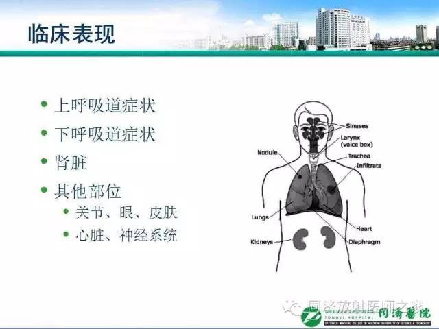 【PPT】肉芽肿性多发血管炎的胸部MSCT特征