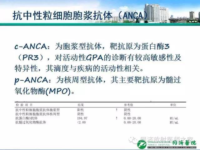 【PPT】肉芽肿性多发血管炎的胸部MSCT特征