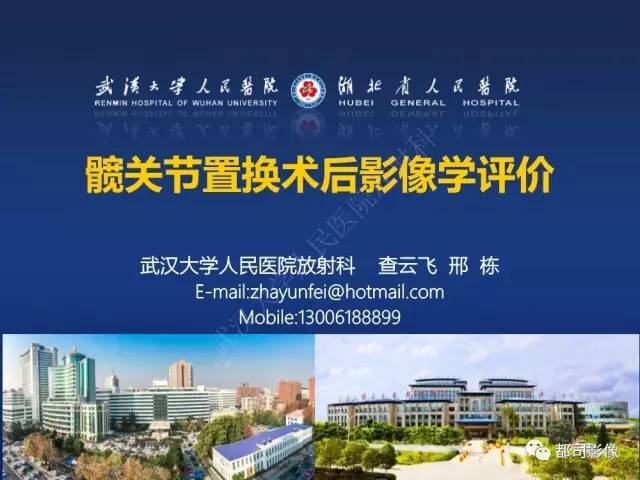 【PPT】髋关节置换术后影像学评价