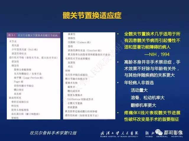 【PPT】髋关节置换术后影像学评价