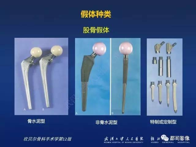 【PPT】髋关节置换术后影像学评价