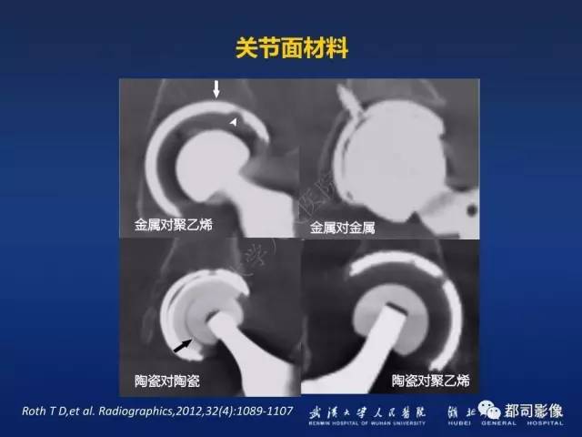 【PPT】髋关节置换术后影像学评价