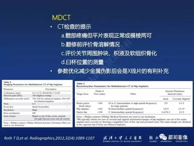【PPT】髋关节置换术后影像学评价
