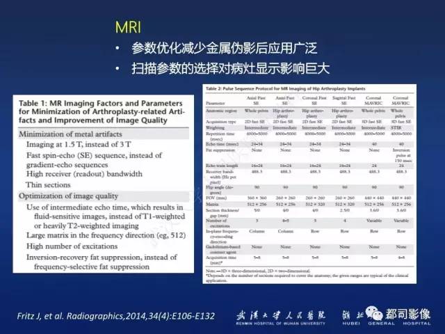 【PPT】髋关节置换术后影像学评价