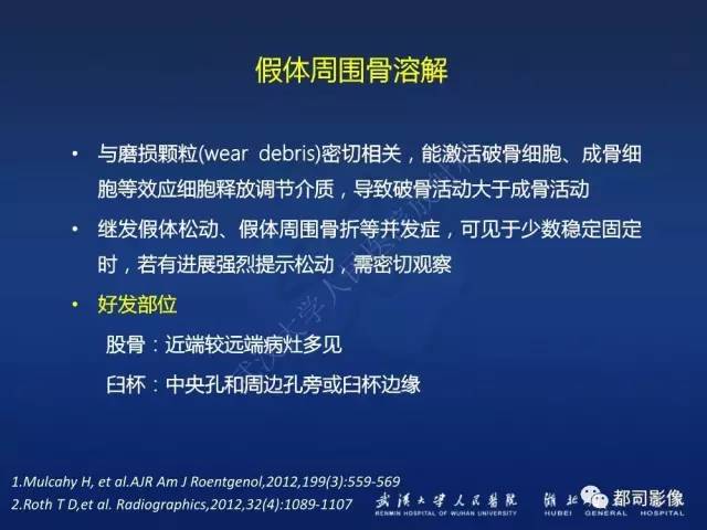 【PPT】髋关节置换术后影像学评价