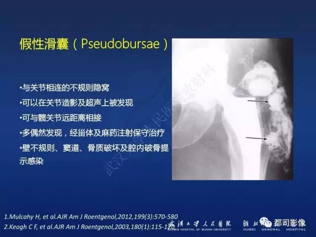 【PPT】髋关节置换术后影像学评价