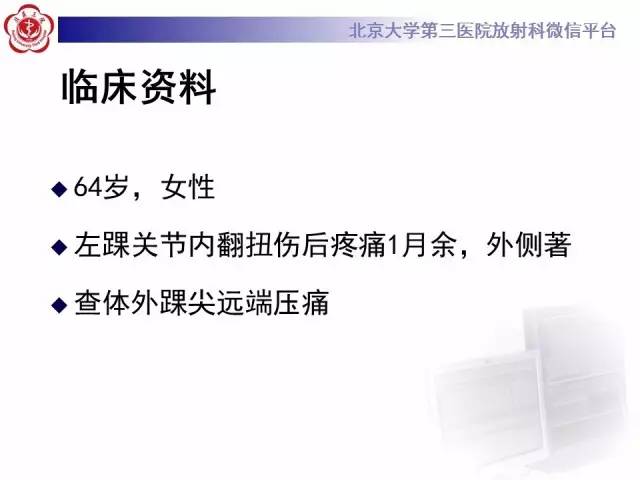 【病例】跗骨窦综合征1例MR影像诊断