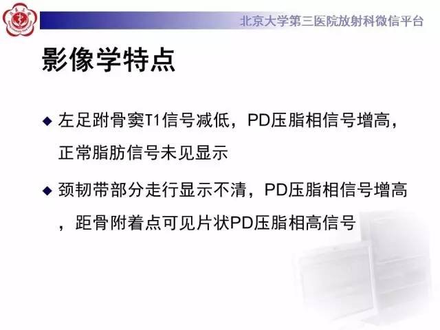 【病例】跗骨窦综合征1例MR影像诊断