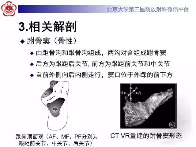 【病例】跗骨窦综合征1例MR影像诊断