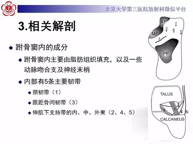 【病例】跗骨窦综合征1例MR影像诊断