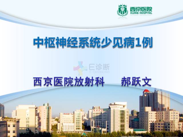 【病例】脑隐球菌病1例MR影像表现