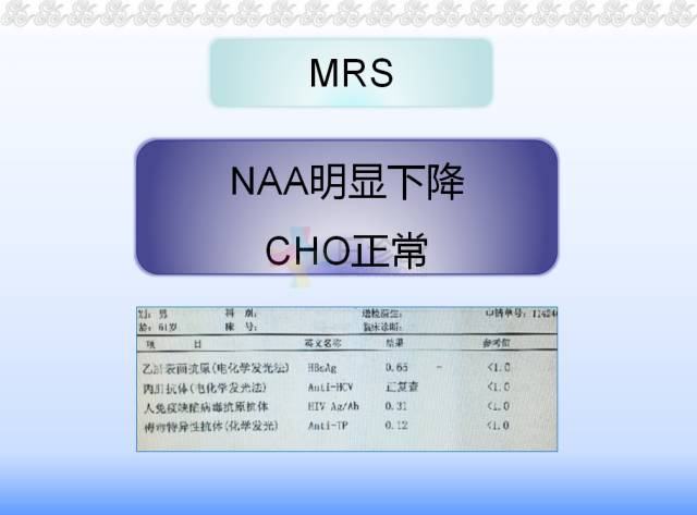 【病例】脑隐球菌病1例MR影像表现