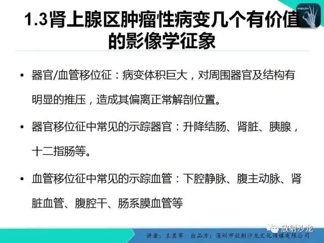 【PPT】肾上腺恶性肿瘤CT诊断