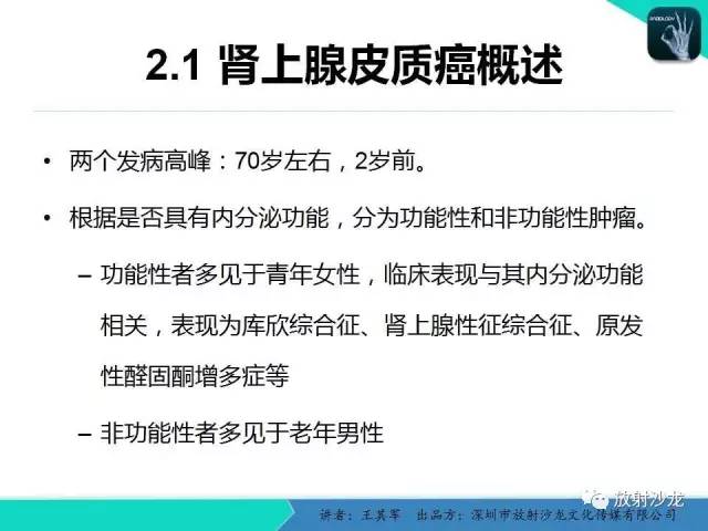 【PPT】肾上腺恶性肿瘤CT诊断
