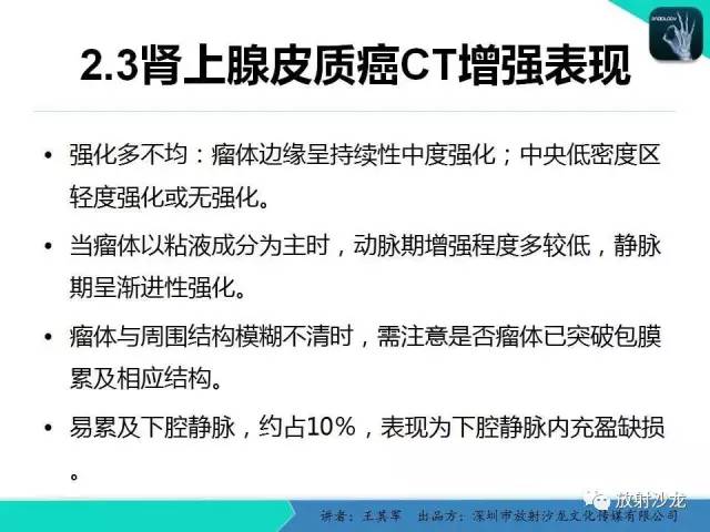 【PPT】肾上腺恶性肿瘤CT诊断